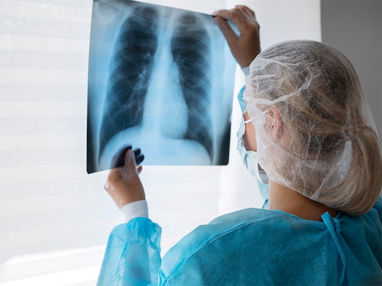 Около 2 млн больных туберкулезом погибают, так как не проходят регулярное обследование: саратовские врачи напомнили о профилактике и наблюдении.